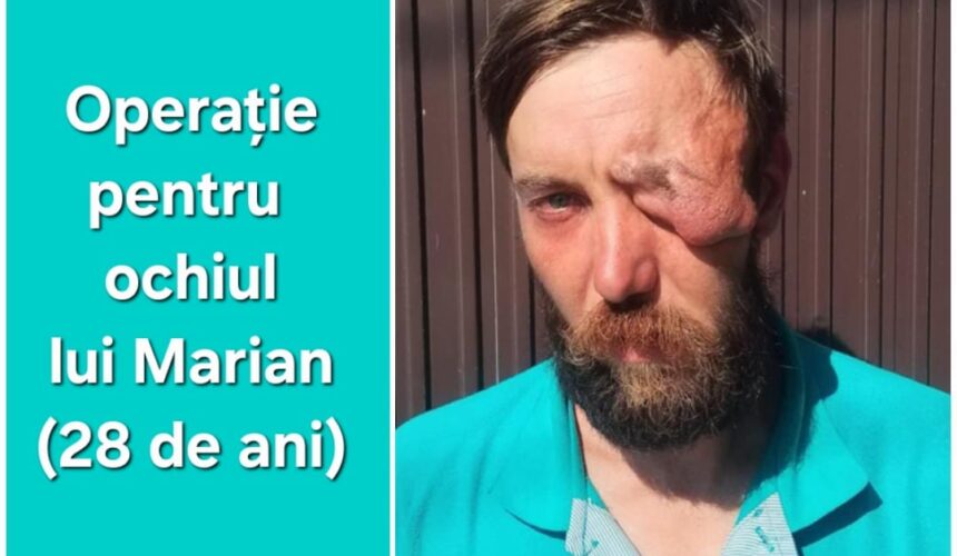Ochii lui Marian Ochii lui Marian
