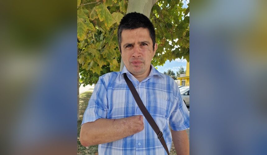 Proteză pentru mâna dreaptă